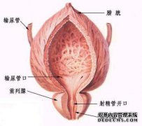 前列腺增生不正规小心癌变